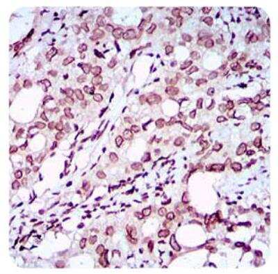 Immunohistochemistry: ZEB1 Antibody (2A8A6) - BSA Free [NBP2-23484]