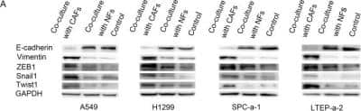 Western Blot: ZEB1 Antibody (2A8A6)BSA Free [NBP2-23484]