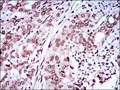 Immunohistochemistry: ZEB1 Antibody (2A8H3) - BSA Free [NBP2-37329]