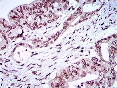 Immunohistochemistry: ZEB1 Antibody (2A8H3) - BSA Free [NBP2-37329]
