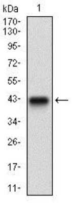 Western Blot: ZEB1 Antibody (2A8H3)BSA Free [NBP2-37329]