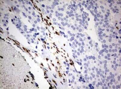 Immunohistochemistry: ZEB1 Antibody (OTI3G6) [NBP2-46398]