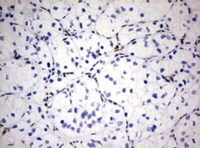 Immunohistochemistry: ZEB1 Antibody (OTI3G6) [NBP2-46398]