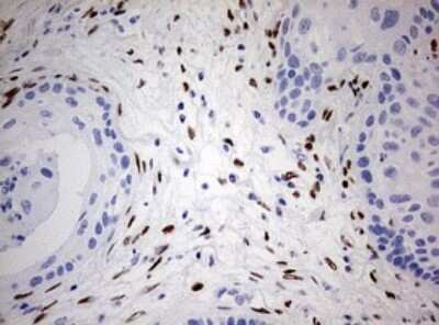 Immunohistochemistry: ZEB1 Antibody (OTI3G6) [NBP2-46398]