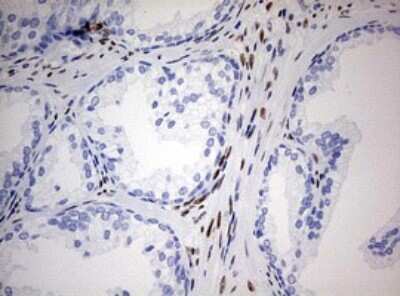 Immunohistochemistry: ZEB1 Antibody (OTI3G6) [NBP2-46398]