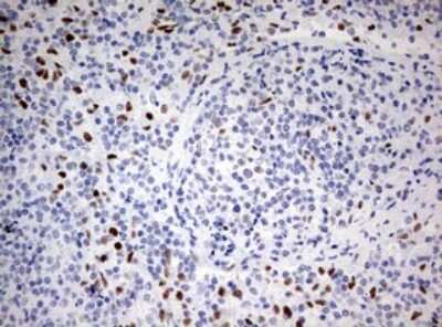 Immunohistochemistry: ZEB1 Antibody (OTI3G6) [NBP2-46398]