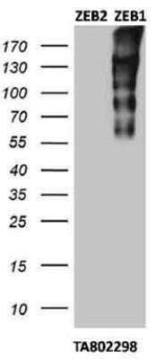 Western Blot: ZEB1 Antibody (OTI3G6) [NBP2-46398]