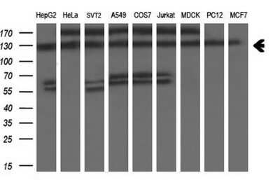 Western Blot: ZEB1 Antibody (OTI3G6) [NBP2-46398]