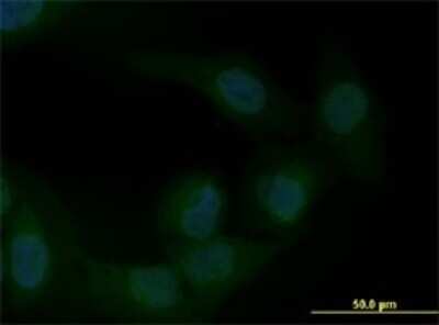 Immunocytochemistry/ Immunofluorescence: ZEB1 Antibody (4C4) [H00006935-M01]