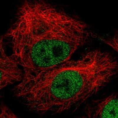 Immunocytochemistry/ Immunofluorescence: ZEB1 Antibody (CL0151) [NBP2-52866]