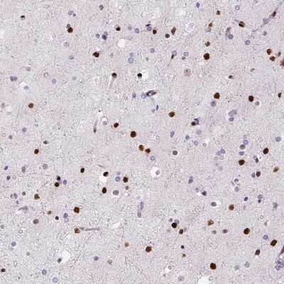 Immunohistochemistry-Paraffin: ZEB1 Antibody (CL0151) [NBP2-52866]