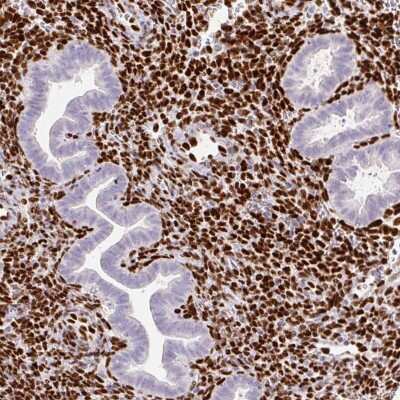 Immunohistochemistry-Paraffin: ZEB1 Antibody (CL0151) [NBP2-52866]