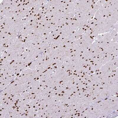 Immunohistochemistry-Paraffin: ZEB1 Antibody (CL0151) [NBP2-52866]