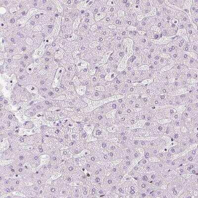 Immunohistochemistry-Paraffin: ZEB1 Antibody (CL0151) [NBP2-52866]