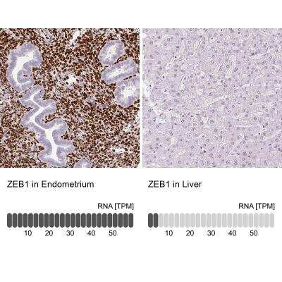 Immunohistochemistry-Paraffin: ZEB1 Antibody (CL0151) [NBP2-52866]