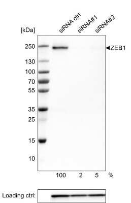 Western Blot: ZEB1 Antibody (CL0151) [NBP2-52866]