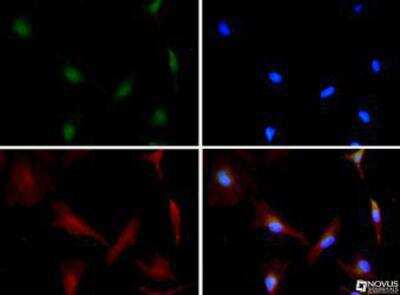 Immunocytochemistry/ Immunofluorescence: ZEB1 Antibody - BSA Free [NBP2-13159]