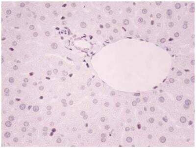 Immunohistochemistry-Paraffin: ZEB1 Antibody [NBP1-05987]
