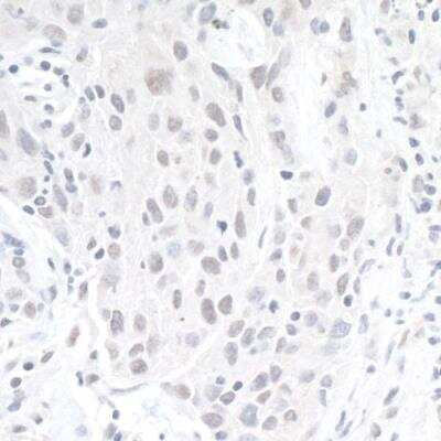 Immunohistochemistry-Paraffin: ZEB1 Antibody [NBP1-05987]