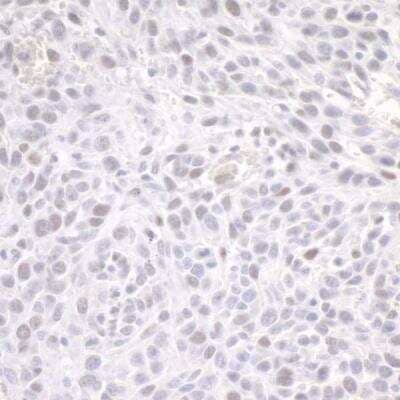 Immunohistochemistry-Paraffin: ZEB1 Antibody [NBP1-05987]