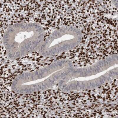 Immunohistochemistry-Paraffin: ZEB1 Antibody [NBP1-88845]