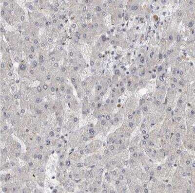 Immunohistochemistry-Paraffin: ZEB1 Antibody [NBP1-88845]