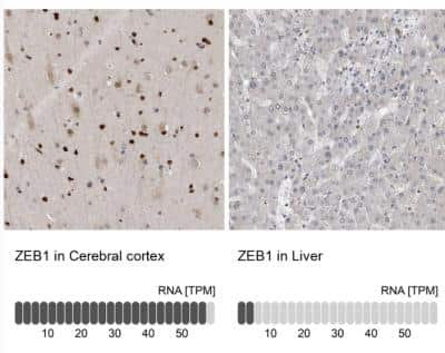 Immunohistochemistry-Paraffin: ZEB1 Antibody [NBP1-88845]