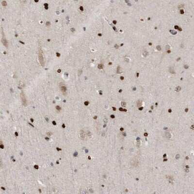 Immunohistochemistry-Paraffin: ZEB1 Antibody [NBP1-88845]