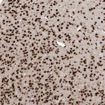 Immunohistochemistry-Paraffin: ZEB1 Antibody [NBP1-88845]