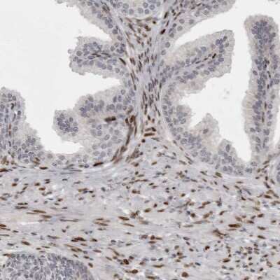 Immunohistochemistry-Paraffin: ZEB1 Antibody [NBP1-88845]
