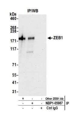 Immunoprecipitation: ZEB1 Antibody [NBP1-05987]