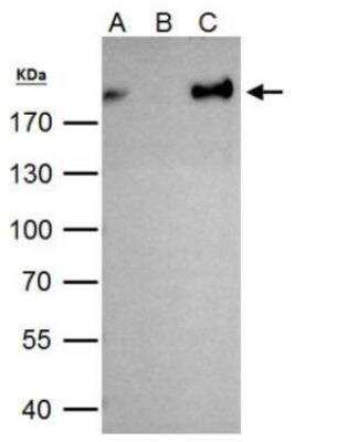 Immunoprecipitation: ZEB1 Antibody [NBP2-20942]