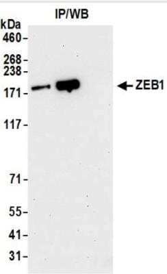 Immunoprecipitation: ZEB1 Antibody (BLR102H) [NBP3-14694]