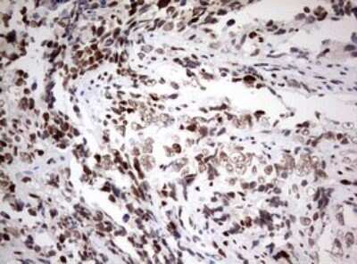 Immunohistochemistry: ZEB1 Antibody (OTI3G6) - Azide and BSA Free [NBP2-74910]