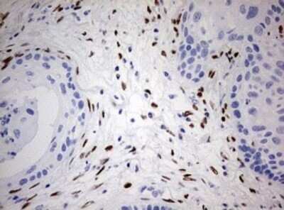 Immunohistochemistry: ZEB1 Antibody (OTI3G6) - Azide and BSA Free [NBP2-74910]