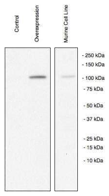 Western Blot: ZEB1 Antibody [NBP1-05987]