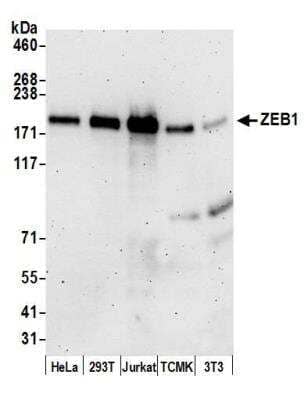 Western Blot: ZEB1 Antibody [NBP1-05987]