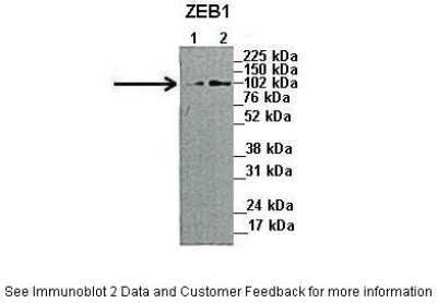 Western Blot: ZEB1 Antibody [NBP1-68930]