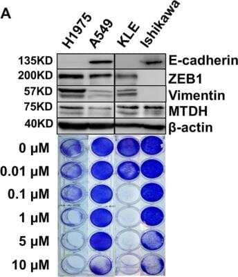 Western Blot: ZEB1 Antibody [NBP1-88845]