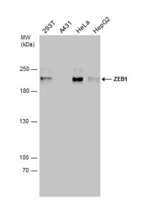 Western Blot: ZEB1 Antibody [NBP2-20942]