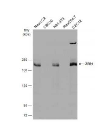 Western Blot: ZEB1 Antibody [NBP2-20942]