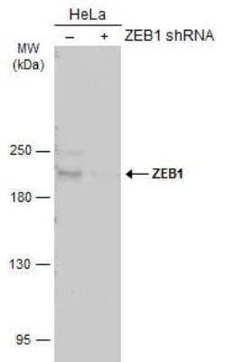 Western Blot: ZEB1 Antibody [NBP2-20942]