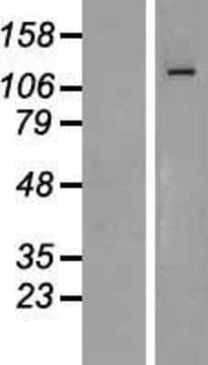 Western Blot: ZEB1 Overexpression Lysate [NBL1-18010]