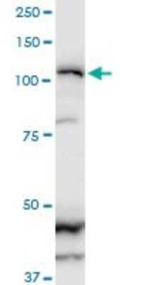 Western Blot: ZEB2 Antibody (2H5) [H00009839-M02]