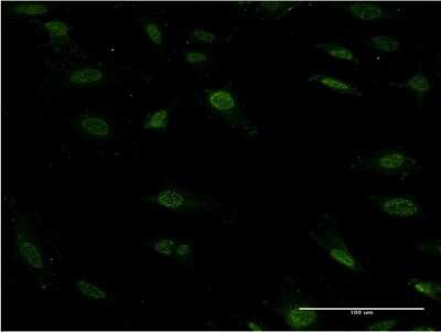 Immunocytochemistry/ Immunofluorescence: ZEB2 Antibody (4G8) [H00009839-M04]