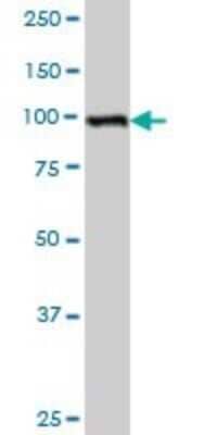 Western Blot: ZEB2 Antibody (4G8) [H00009839-M04]