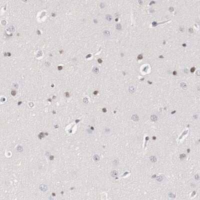 Immunohistochemistry-Paraffin: ZEB2 Antibody [NBP1-82991]