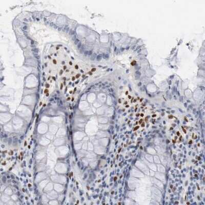 Immunohistochemistry-Paraffin: ZEB2 Antibody [NBP1-82991]