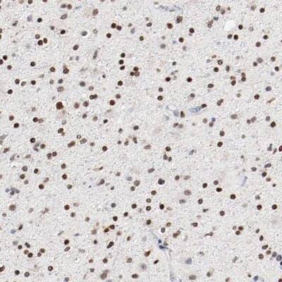 Immunohistochemistry-Paraffin: ZEB2 Antibody [NBP1-82991]