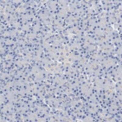 Immunohistochemistry-Paraffin: ZEB2 Antibody [NBP1-82991]